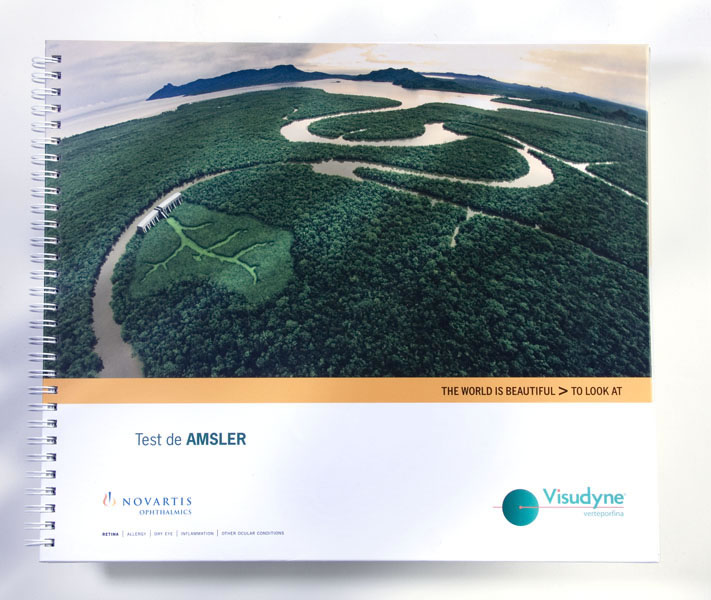 Test de Amsler - 1