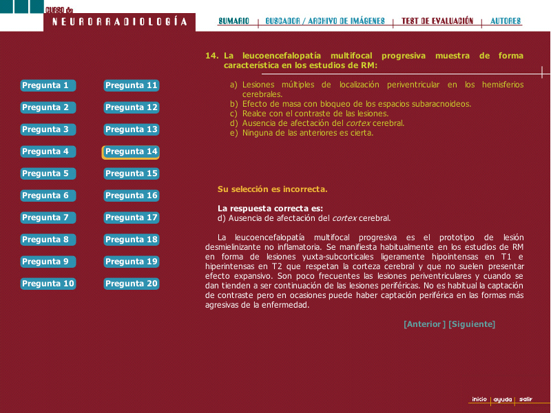 Curso de Neurorradiología - 5