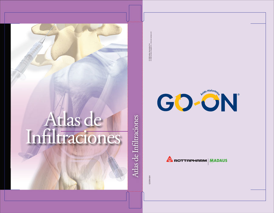 Atlas de Infiltraciones - 1