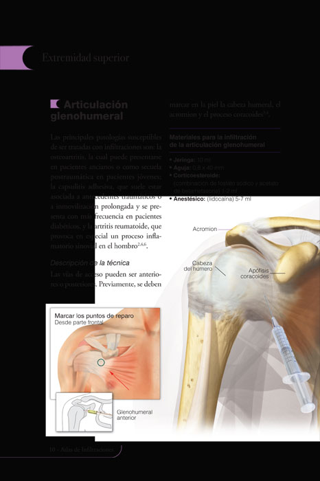 Atlas de Infiltraciones - 2