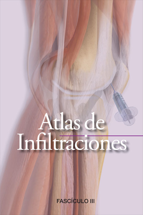 Atlas de Infiltraciones - 5