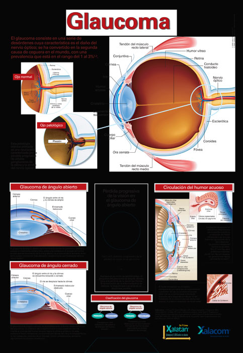 Disco Giratorio Glaucoma - 1