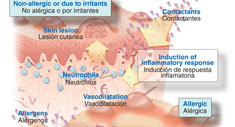 Minidiccionario Dermatología
