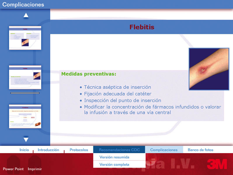 Terapia Intravenosa - 5