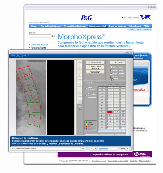 MorphoXpress.com - 3