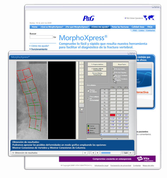 MorphoXpress.com - 4