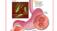 Display Box Afecciones Gastrointestinales