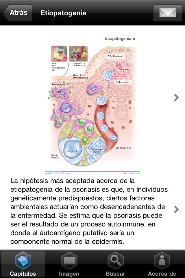 Aplicación iPhone y iPad Miniatlas Psoriasis - 3