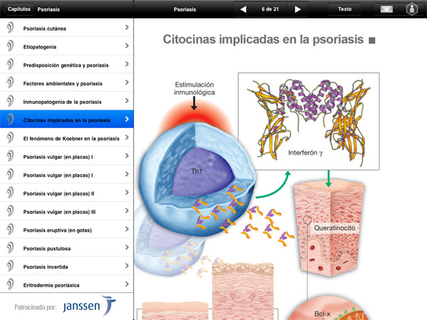 Aplicación iPhone y iPad Miniatlas Psoriasis - 5