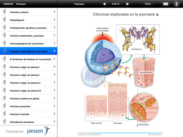 Aplicación iPhone y iPad Miniatlas Psoriasis - 6