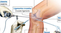 Diccionario Traumatología