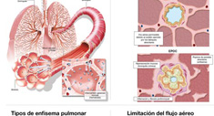 PosterMaker Visitadores sobre EPOC