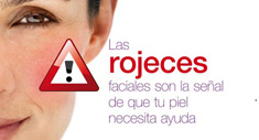 Stop Rojeces