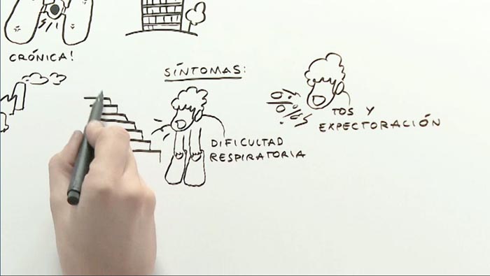 Ilustrando la EPOC - 3