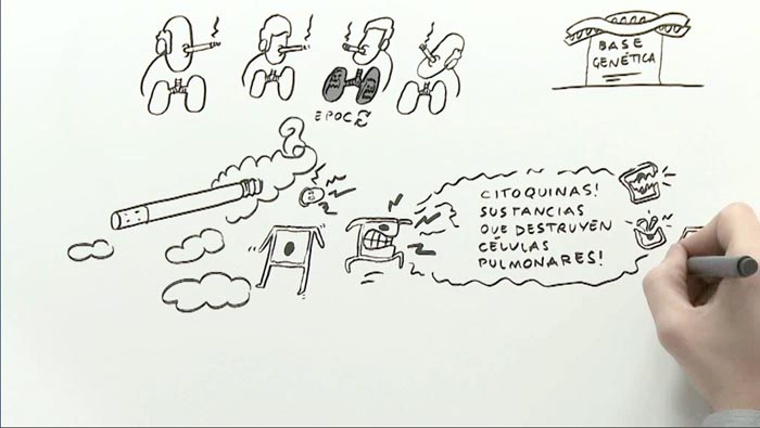 Ilustrando la EPOC - 6