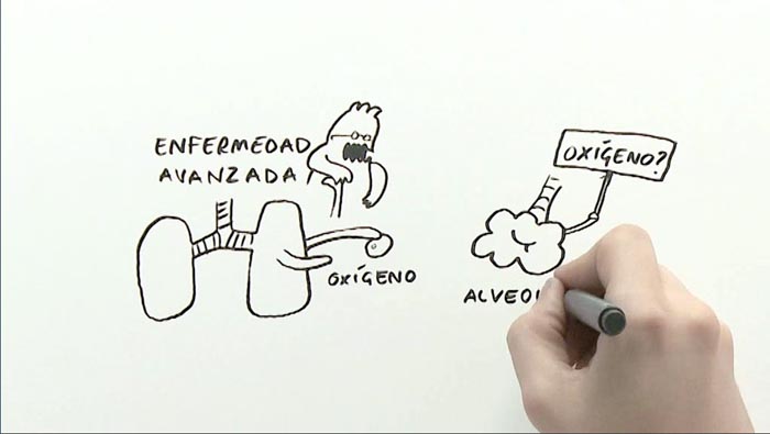 Ilustrando la EPOC - 8