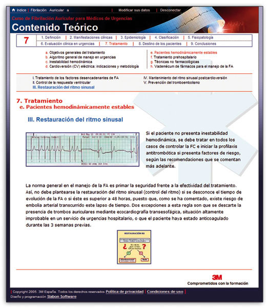 Curso Fibrilación auricular online - 1