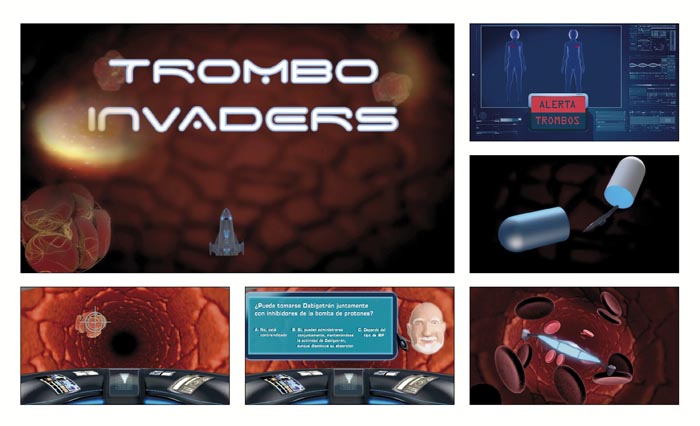 Trombo Invaders - 2