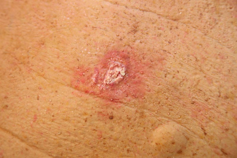 Oversized Derma Trainning Head - 5