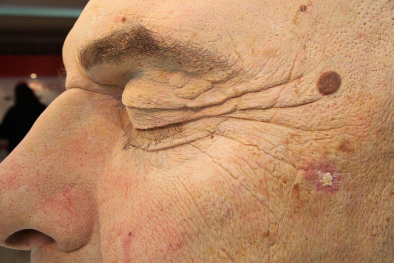 Oversized Derma Trainning Head - 6