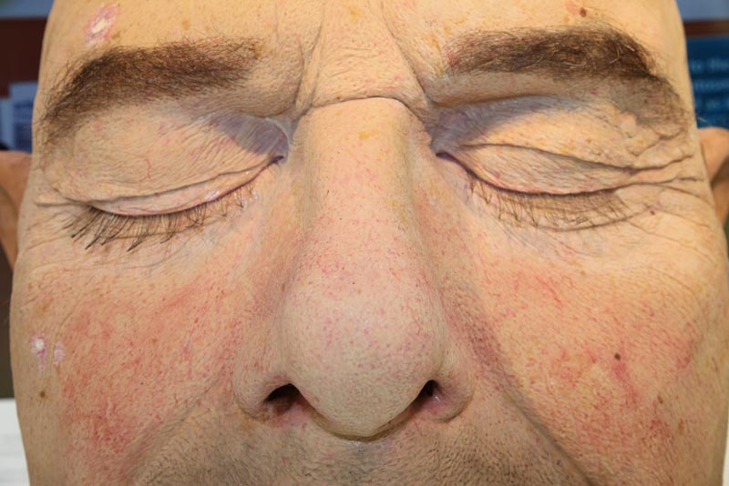 Oversized Derma Trainning Head - 7