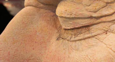 Oversized Derma Trainning Head