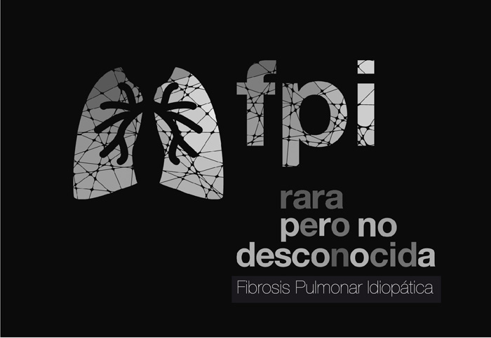 Rara pero no desconocida - 3