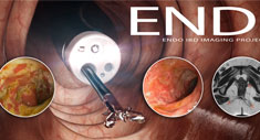 ENDI Endo IBD Imaging Project