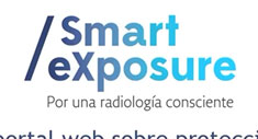 Smart eXposure