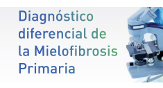 Diagnóstico Diferencial de la MF Primaria