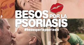 Besos por la psoriasis