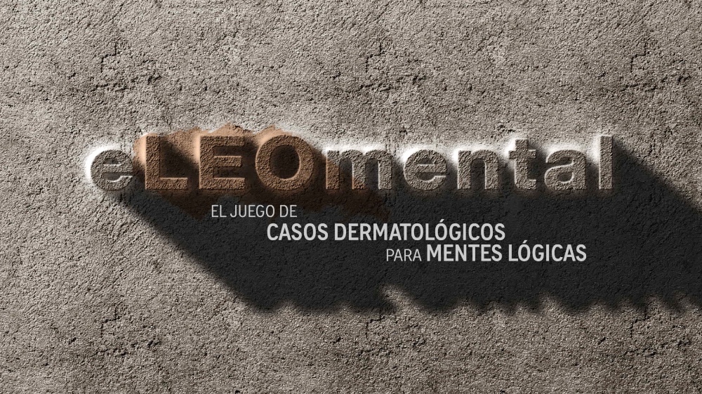 eLEOmental - 2