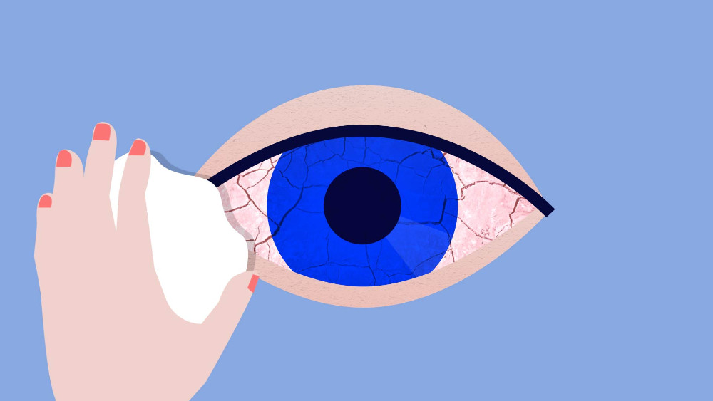 Higiene palpebral con Lephanet - 5