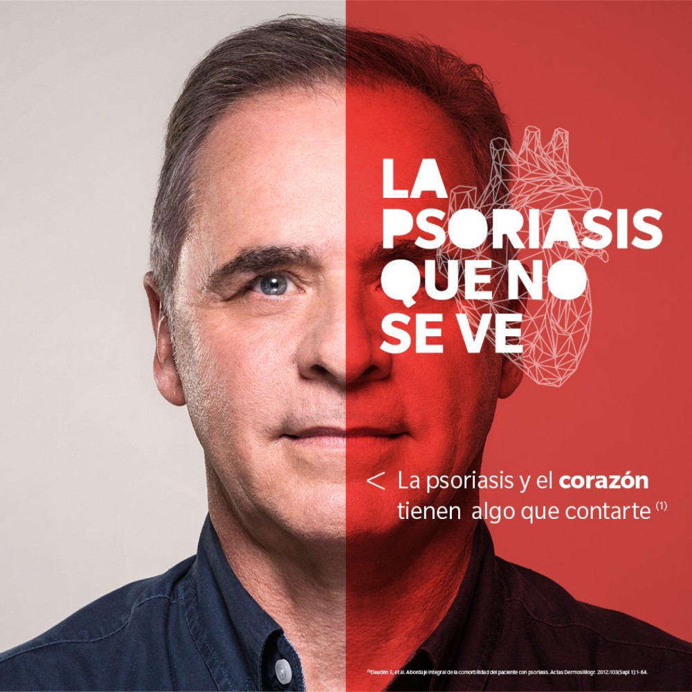 La Psoriasis que No Se Ve - 3