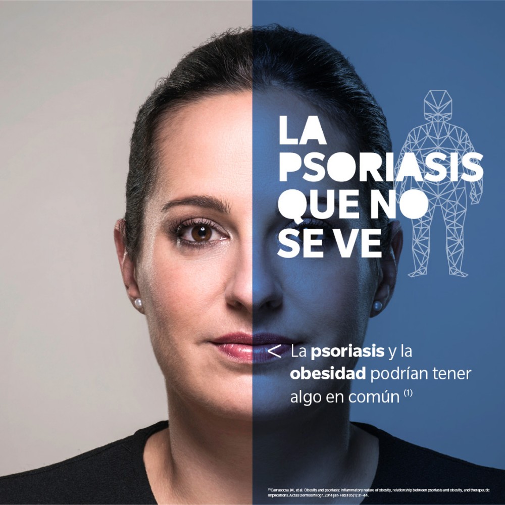 La Psoriasis que No Se Ve - 5