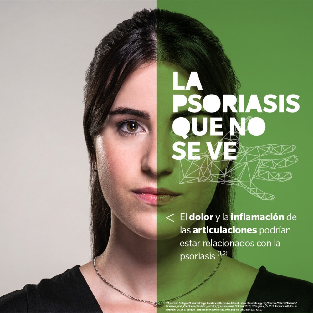 La Psoriasis que No Se Ve - 6