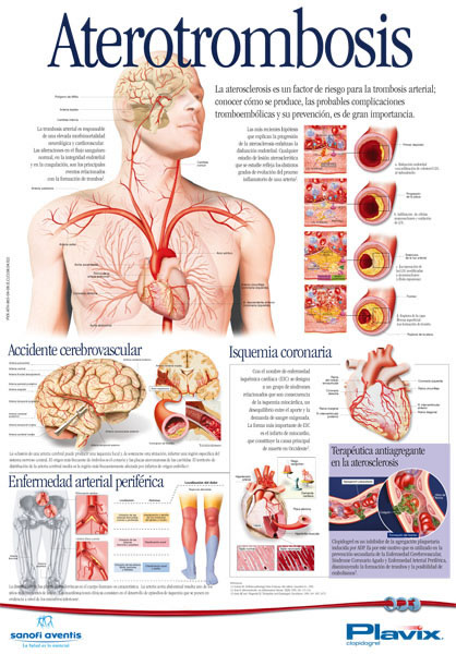 Poster Aterotrombosis - 1