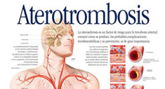 Poster Aterotrombosis
