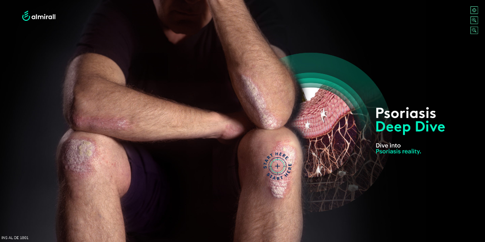 Psoriasis Deep dive - 4
