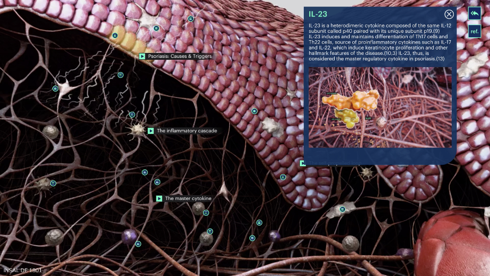 Psoriasis Deep dive - 6