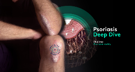 Psoriasis Deep dive