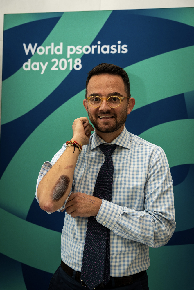 World Psoriasis Day - 3
