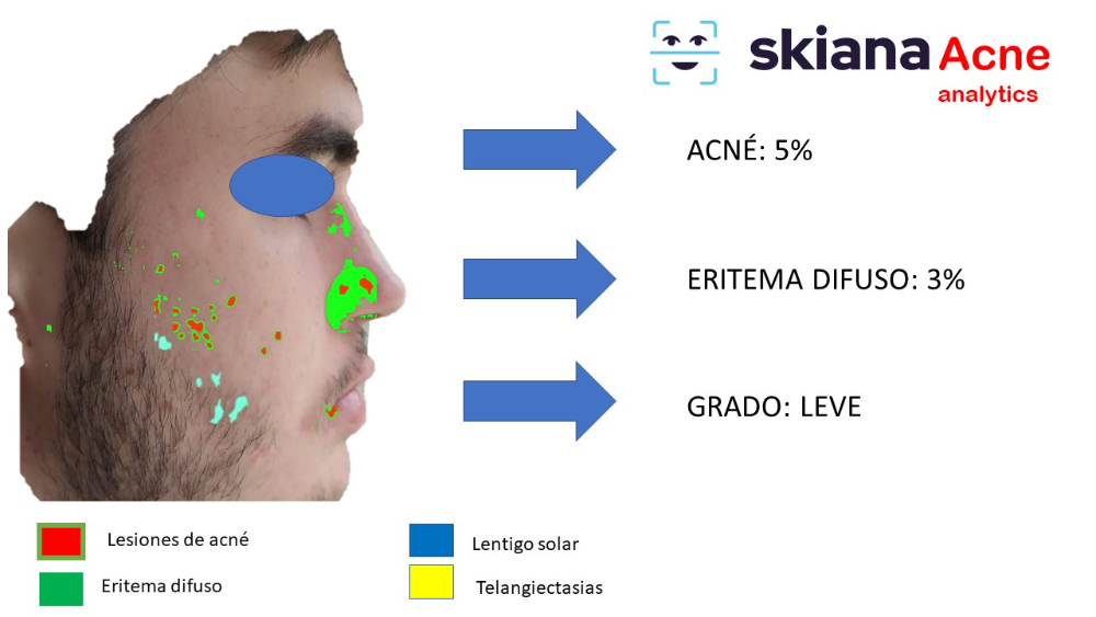 Proyecto SKIANA®Care: Asistente cosmético virtual - 6