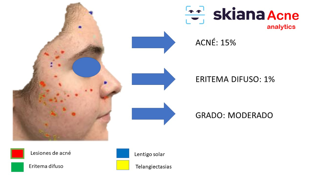 Proyecto SKIANA®Care: Asistente cosmético virtual - 7