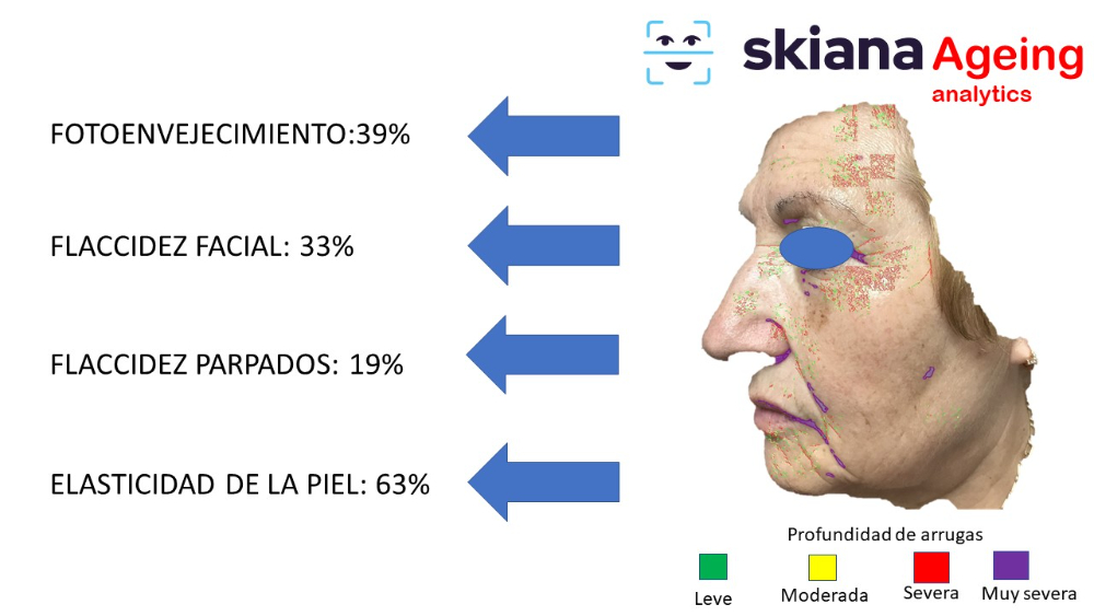 Proyecto SKIANA®Care: Asistente cosmético virtual - 8