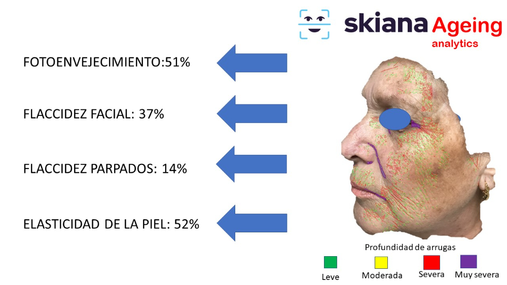 Proyecto SKIANA®Care: Asistente cosmético virtual - 9