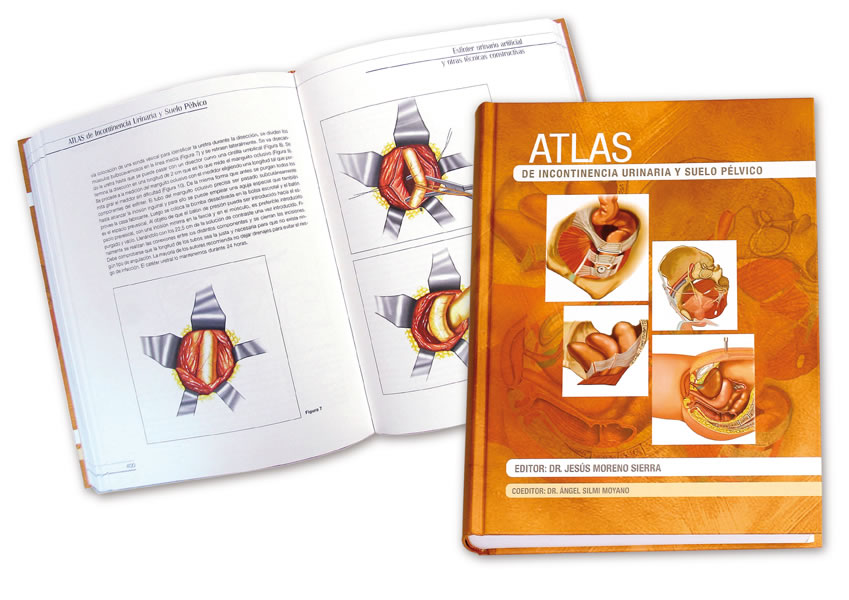 Atlas de incontinencia urinaria - 1