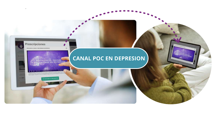 Canal POC en Depresión - 2