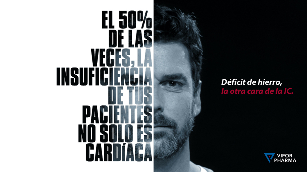 LA OTRA CARA DE LA IC - 4