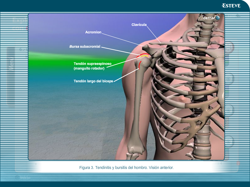 Exploración paciente dolor osteoarticular - 5
